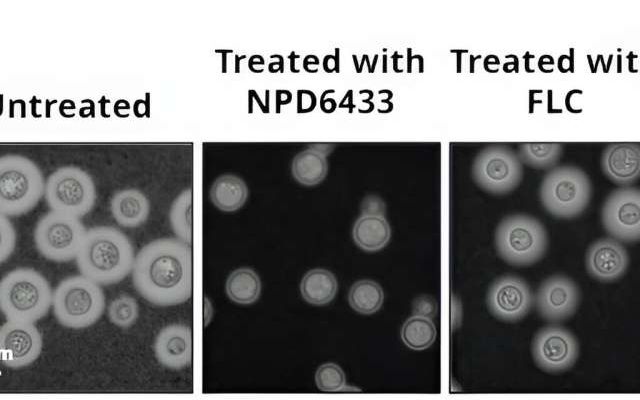 Deadly fungus beaten with new type of treatment